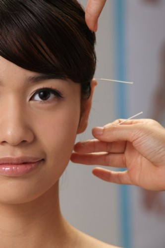 Acupuncture For Weight Loss Tips in New Website