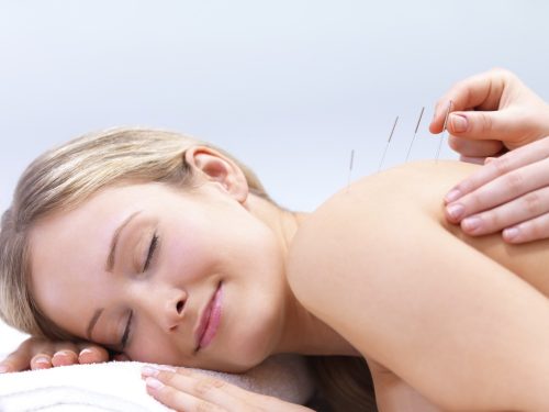 Acupuncture Center Leman Launches New Center In The City of Rotterdam