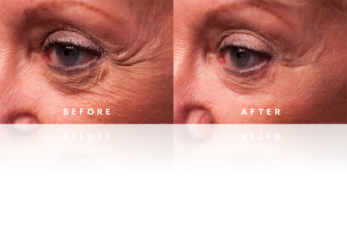 Best Anti Aging Skin Wrinkle Serum Instantly Ageless Cream Just Released