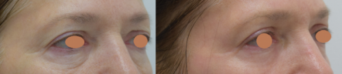 Skin Deep Laser Services is Northern VA’s #1 Resource for Laser Skin Resurfacing