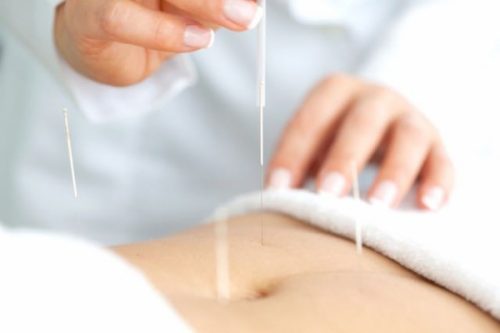 Acupuncture and Natural Pregnancy Surprising Facts Reveled