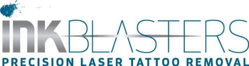 Detroit Michigan Laser Tattoo Removal Clinic Using Industry’s Top Laser