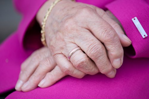 54.4 Million US Adults are Diagnosed with Arthritis, Annually