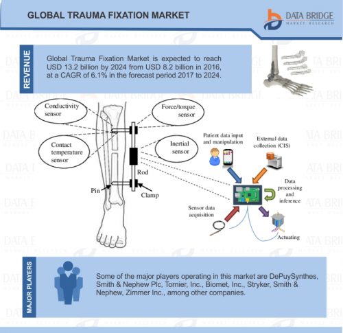 Trauma Fixation Market Analysis – Global Industry Size, Application Analysis, Regional Outlook, Competitive Strategies and Forecasts, 2017 to 2024