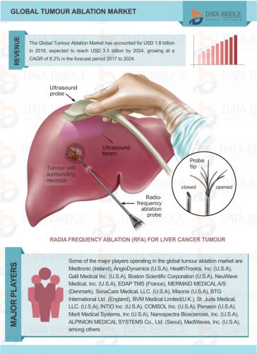 Global Tumour Ablation Market Trends by Key Vendors and Market Scenario Worth USD 3.5 Billion by 2024