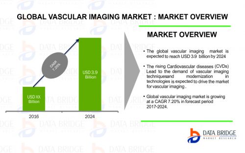 Global Vascular Imaging Market 2017 Outlook, Leading Key Players, Growth, Trends and Future Investments split by Region Forecast to 2024