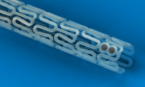 Global Stents Market Present Status and Growth Prospects worth USD 4.5 Billion by 2024