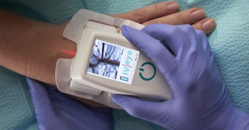 Vitacon US Demonstrates Innovative Portable Vein Finder At Phoenix AVA Meeting
