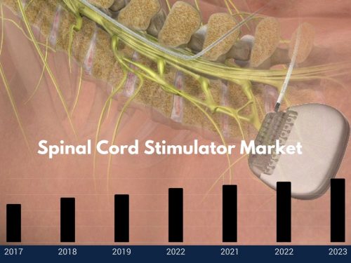 Qualitative and Quantitative factors driving the Spinal Cord Stimulator ...