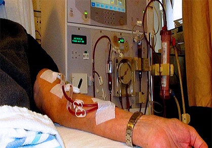 Indiana Insights Renal Dialysis Market Advancements In Technology Driving The Renal Dialysis Indusrty By Type Product End User Till 2023