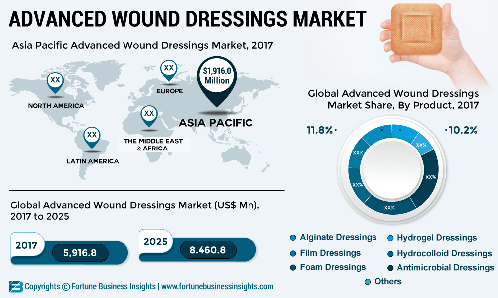 Advanced Wound Dressings Market 2019 Industry Size, Share, Global