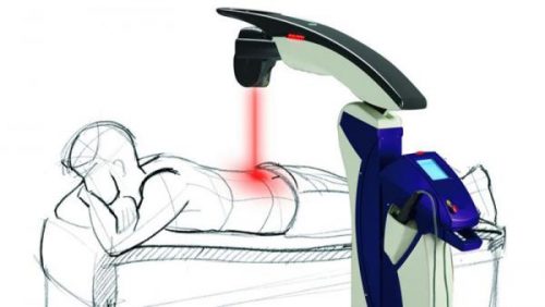 Medina OH Spine/Joint Pain Relief Chiropractor – Robotic Laser Therapy Launched